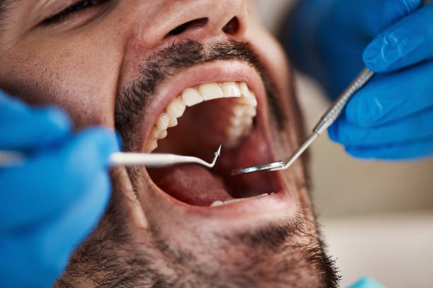 Why Choose Us for Your Dental Needs in Benson, AZ